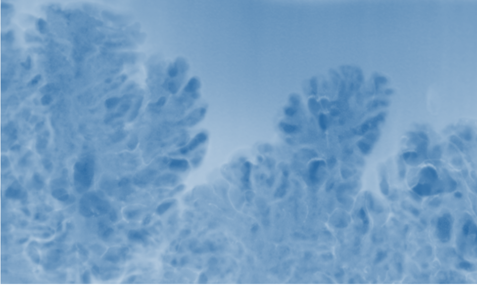 A novel perspective on the degradation of Si-based anodes