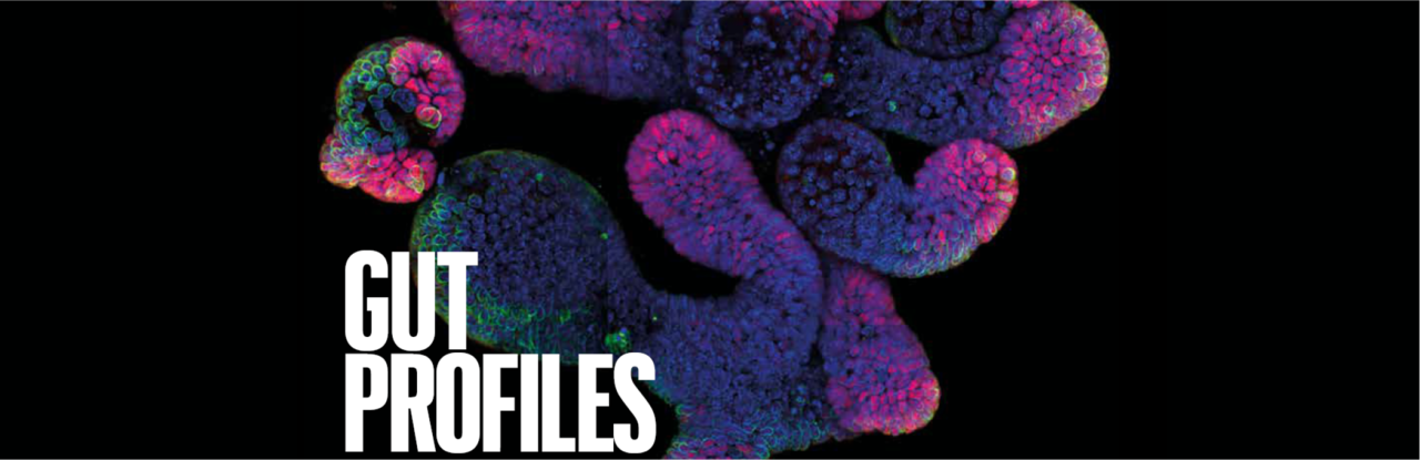 Intestinal regeneration: lessons from organoids