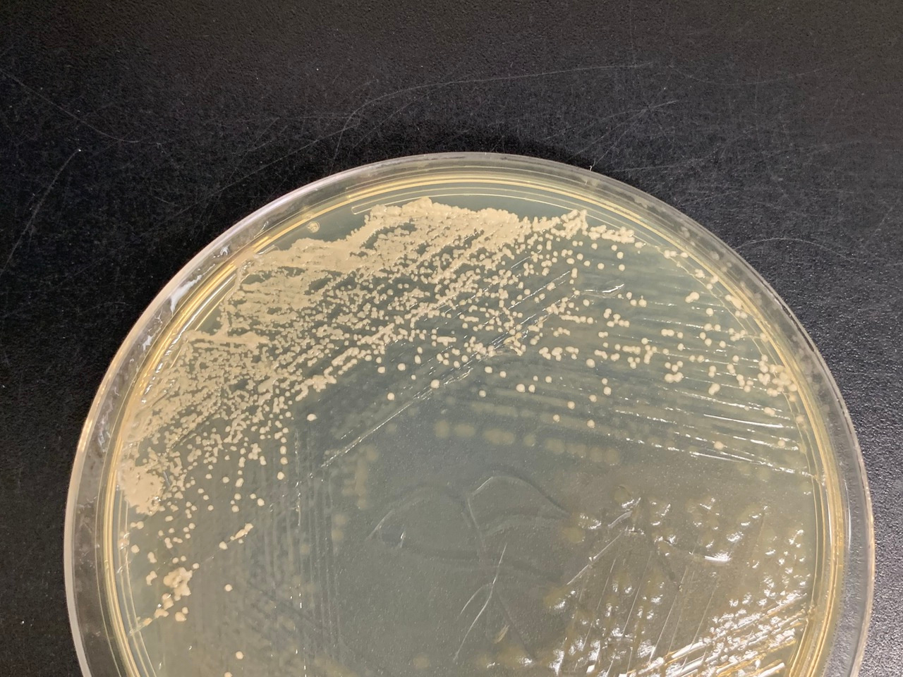 Stuck in the middle with you: Coevolution in microbes