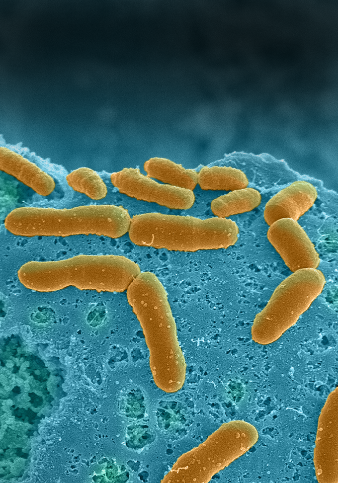 After the Paper | Human Intestine Chip: From Emulating Host-Microbiome Interactions to Disease Modeling and Therapeutic Development
