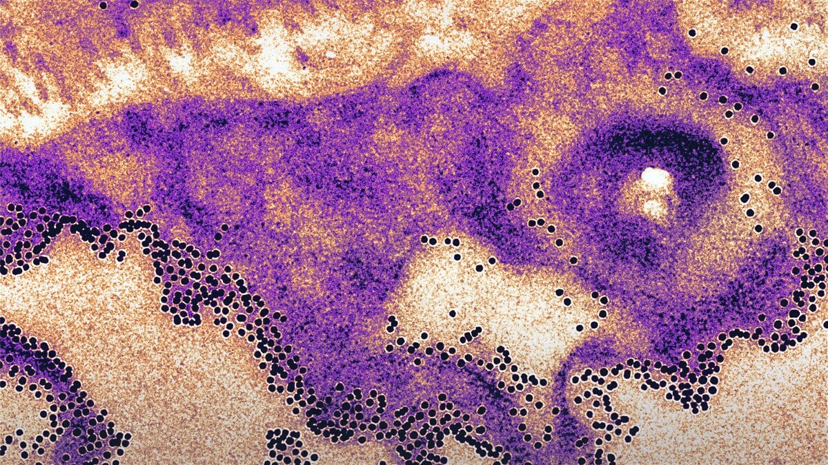 3rd Frontiers in Electron Microscopy for Physical and Life Sciences