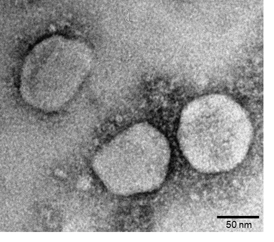 Potential of bat CoVs in the emergence of new CoV epidemics in human: a lesson from studying Ty-BatCoV HKU4
