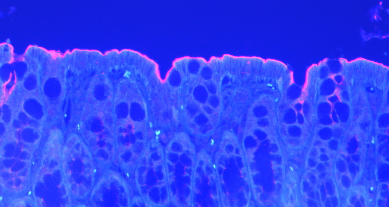 Tumour suppressor activity of the atypical cadherin MUCDHL in the gut