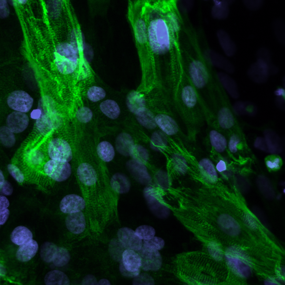 Towards somatic cell genome editing therapies