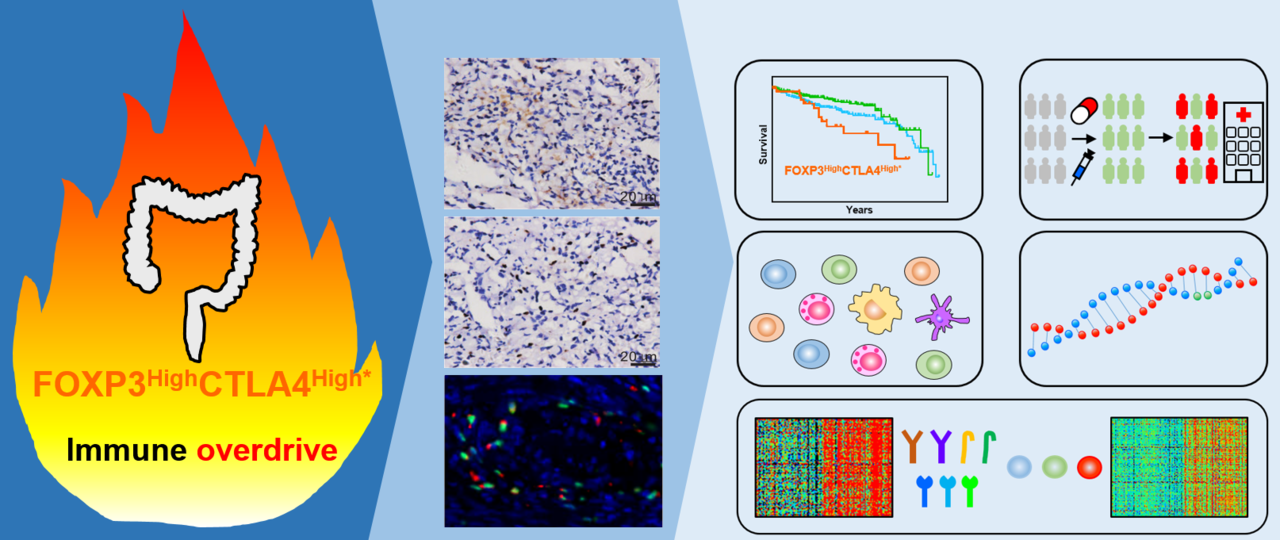 Immune overdrive high-risk subpopulations in colorectal cancer