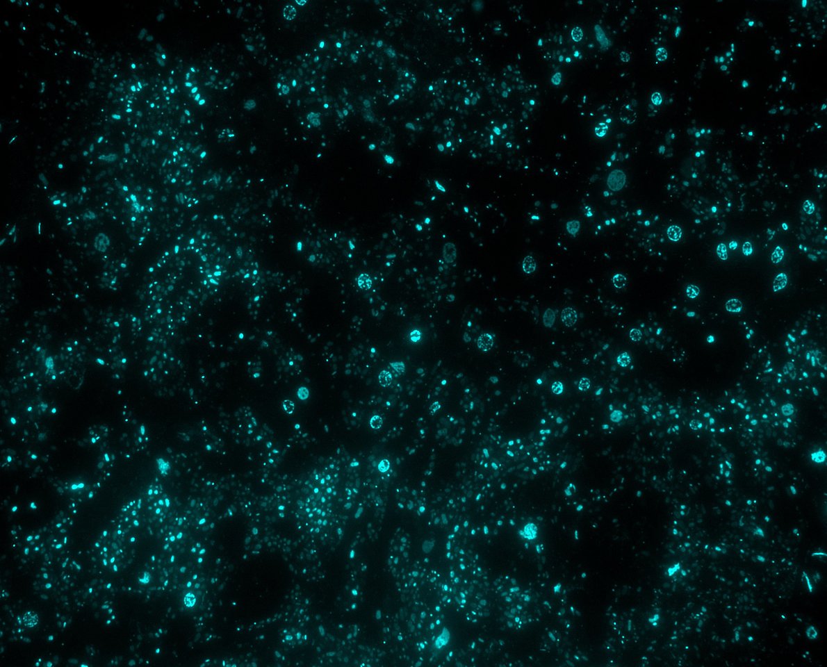 Sponges set the stage for phage-symbiont interplay