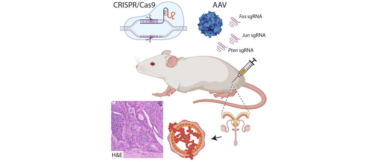 AP-1/Fos function in prostate cancer; An in vivo CRISPR/Cas9 approach