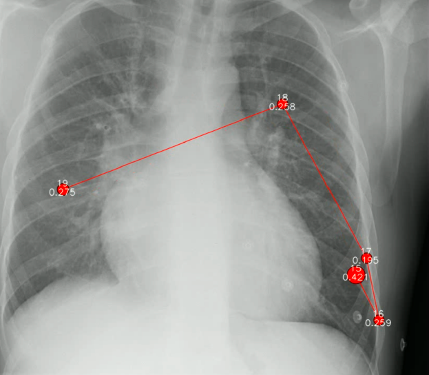 Creation and validation of a chest X-ray dataset with eye-tracking and report dictation for AI development