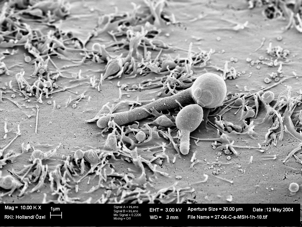 Mighty-chondria make immunity against fungi go viral