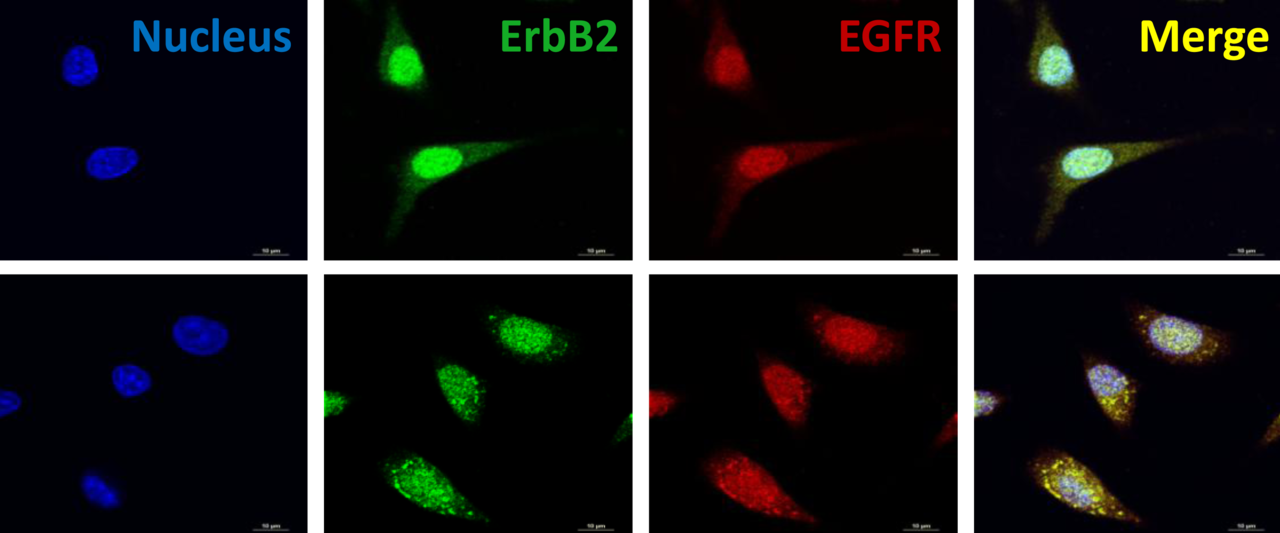 Epiregulin promotes EGFR-TKI resistance in non-small cell lung cancer