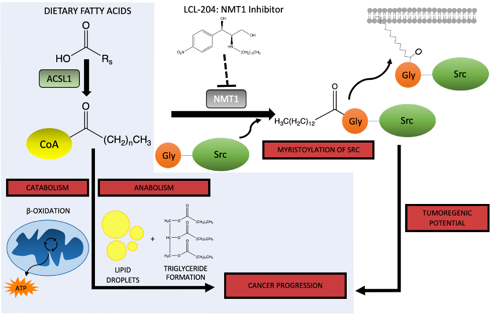 Fatty acid metabolism and prostate cancer – Following the science to where it leads us 