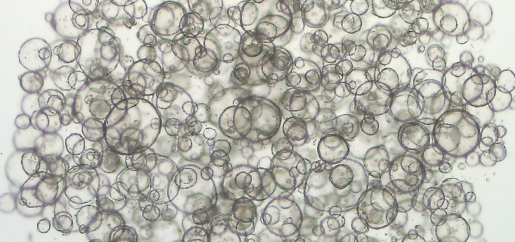 Can organoids revolutionize personalized treatment in cancer patients?