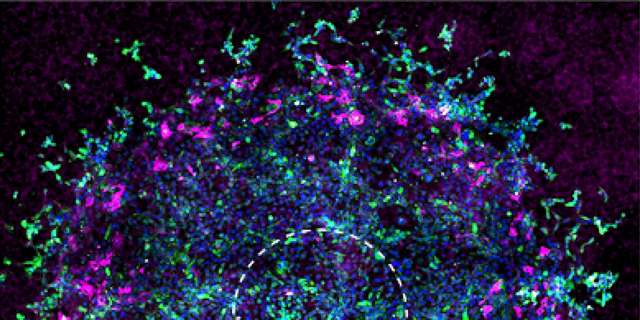 
An in vitro tumorigenesis model based on live-cell-generated oxygen and nutrient gradients
