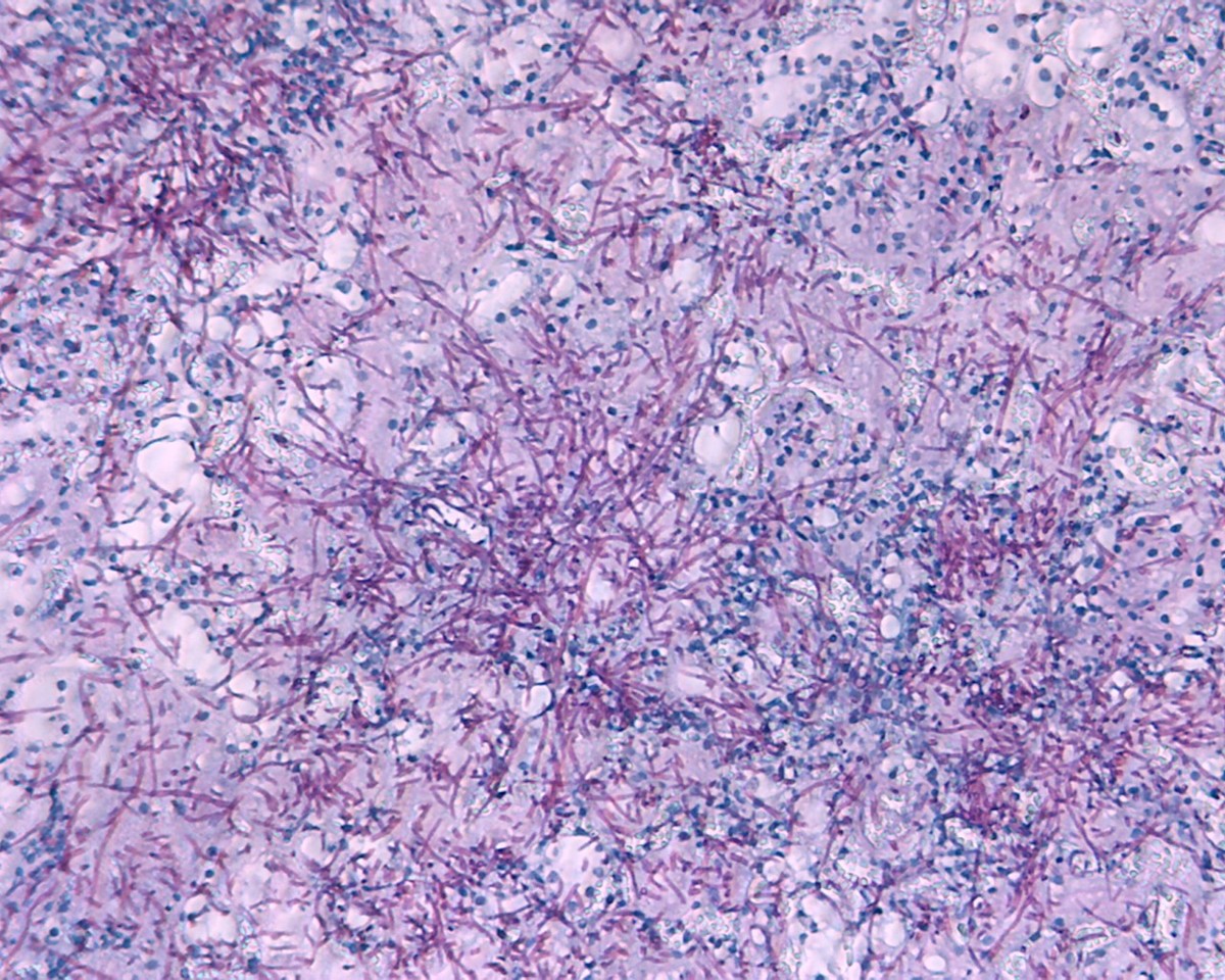 Antibiotics, microbiota-derived peptidoglycan, and Candida albicans infection