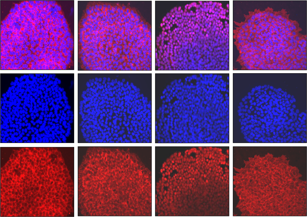 Targeting CREB-binding protein (CBP) abrogates colorectal cancer stemness through epigenetic regulation of C-MYC