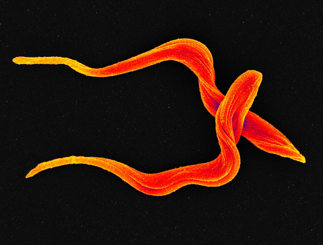 Towards a vaccine against the most neglected of neglected tropical diseases?