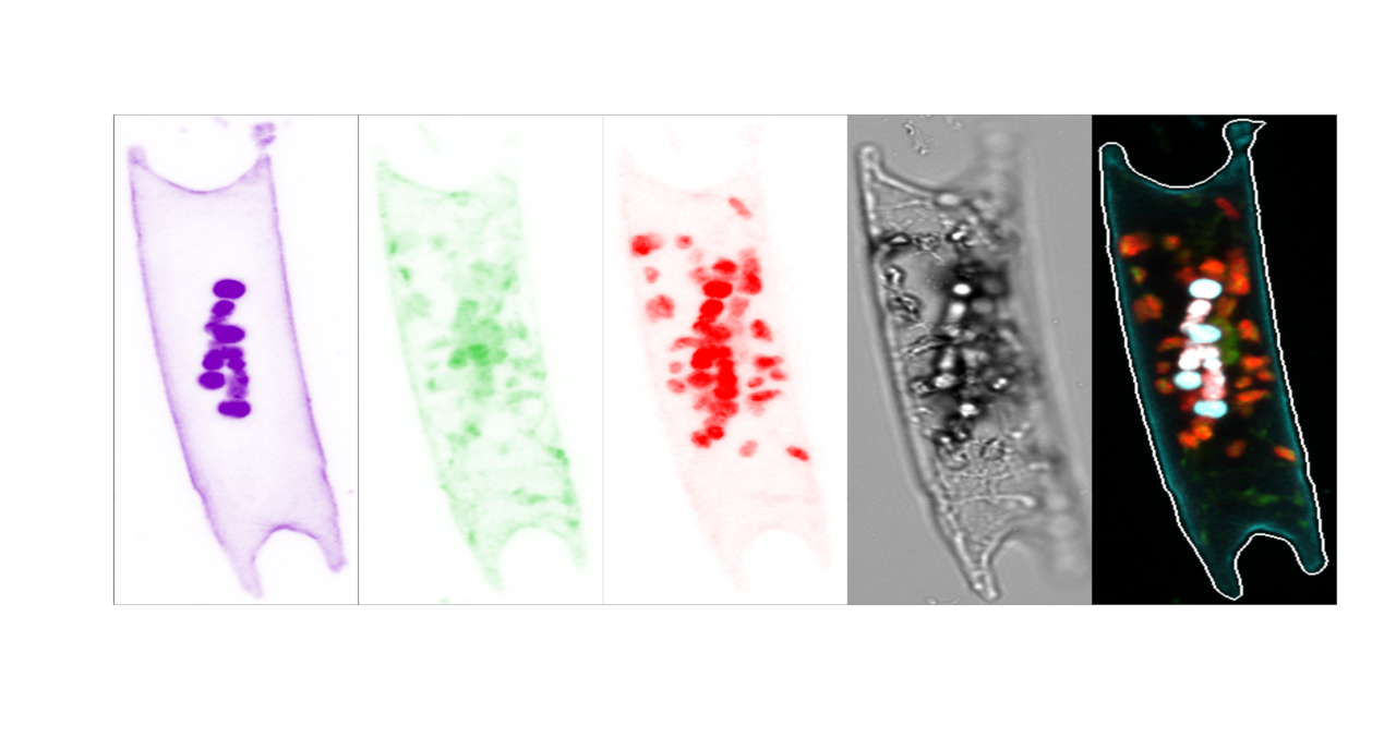 A global ocean snapshot of nitrogen fixers by matching sequences to cells in the Tara Ocean