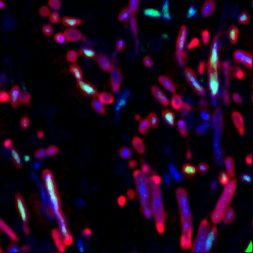 Where do antibiotics go within cells?  The impact of mycobacterial intracellular lifestyle in tuberculosis chemotherapy