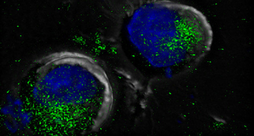 The power of iPSC extracellular vesicles in boosting hematopoiesis