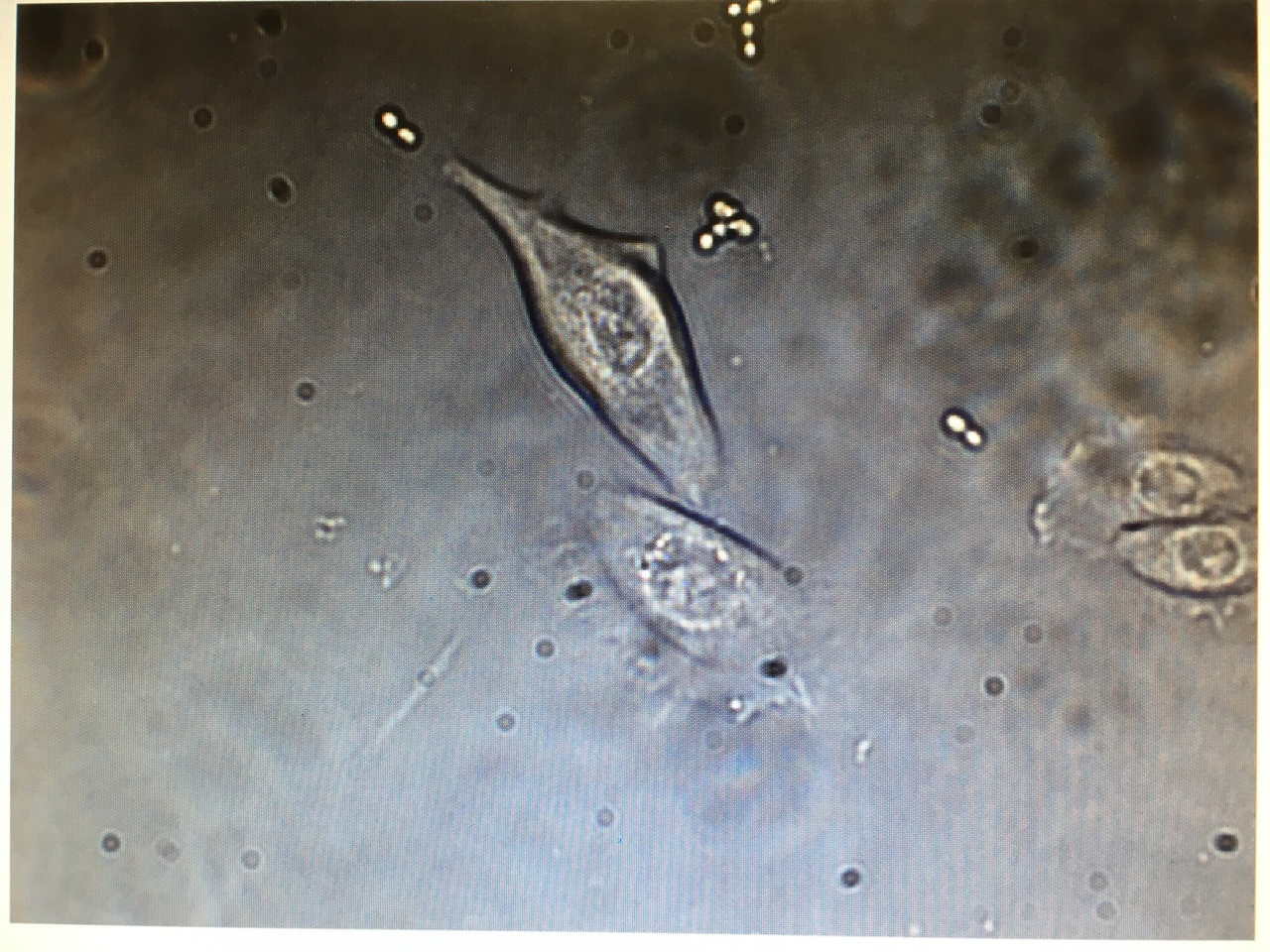 A very close look into the molecular basis of adhesion and biofilm establishment by Candida glabrata