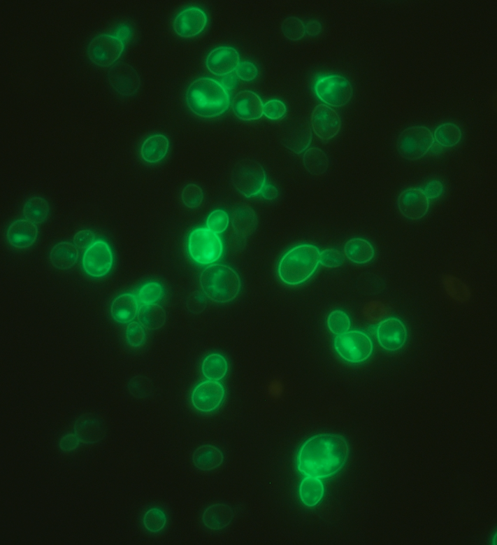 Finding a new family of azole drug importers in pathogenic fungi