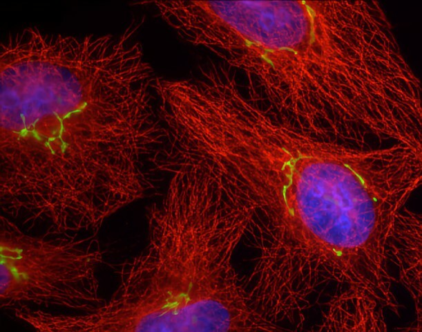 Biotech startup: Franck Perez, Honing Biosciences