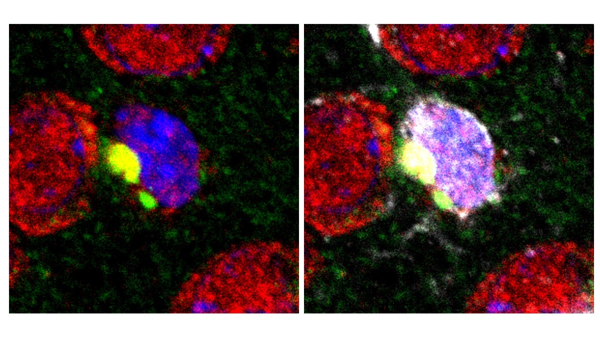 PQBP1, a new player for brain inflammation under neurodegeneration, suggests that disease proteins are recognized as exogenous pathogens by microglia