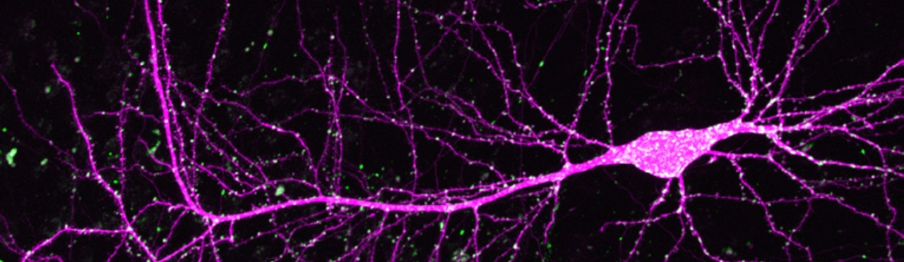 MerMAIDs: The hunt for new channelrhodopsins