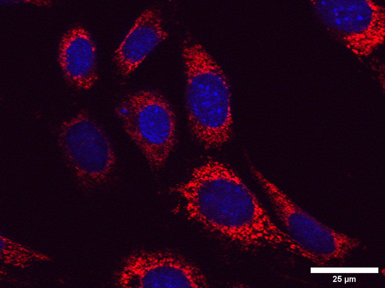 Blog 01: Mens Sana in Corpore Sano
