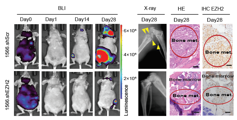 Why are high EZH2-expressing breast cancer cells prone to bone metastasis?