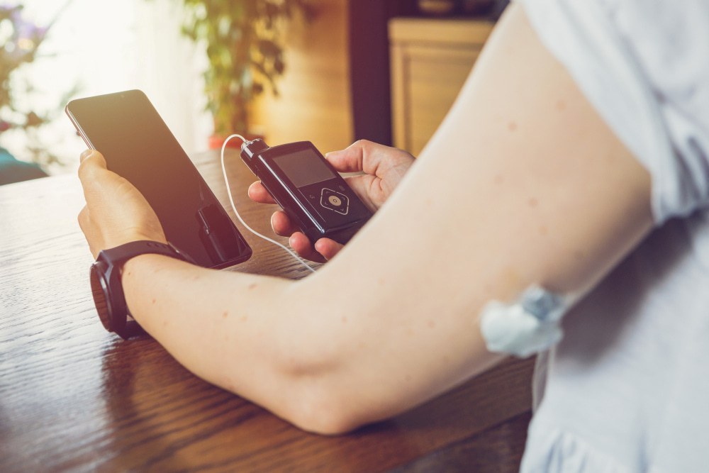 Sex-specific lipidome changes associated with diabetes