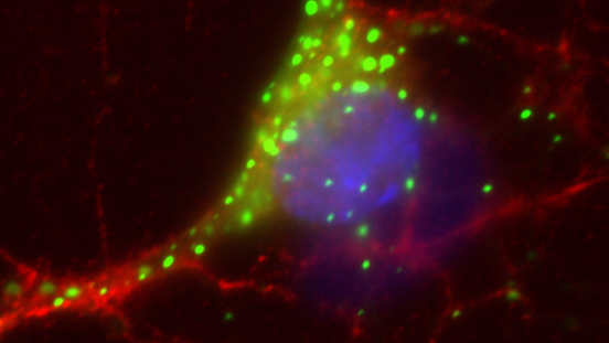 Anne Bertolotti: "My interest in science is curiosity driven."