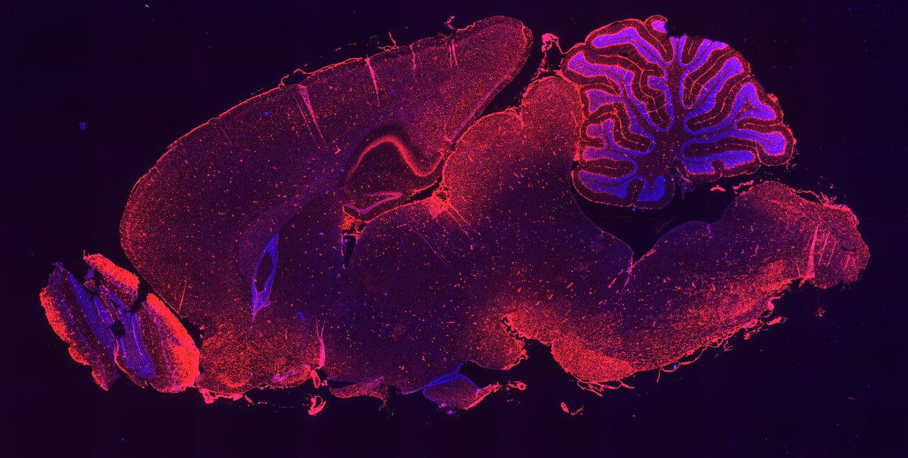 Expanding the Reach of RNAi Therapeutics with Next Generation Lipophilic siRNA Conjugates