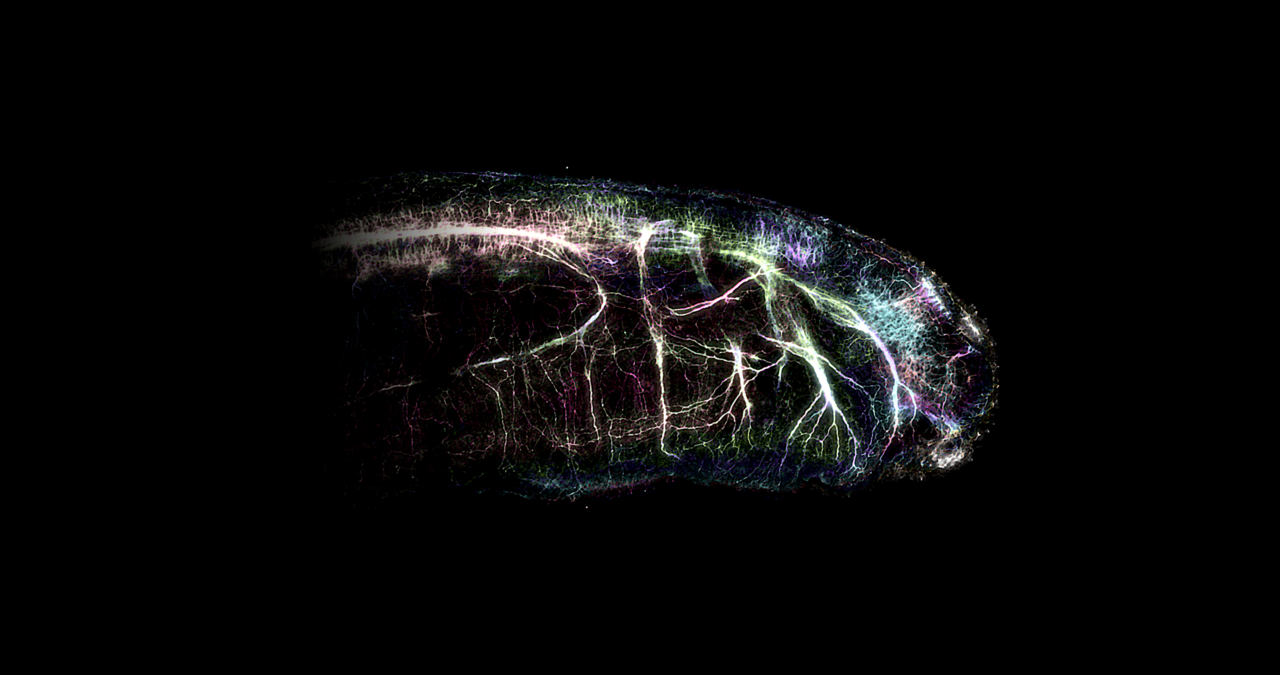 Heads or tails : Shared legacy of ancient sensory neurons