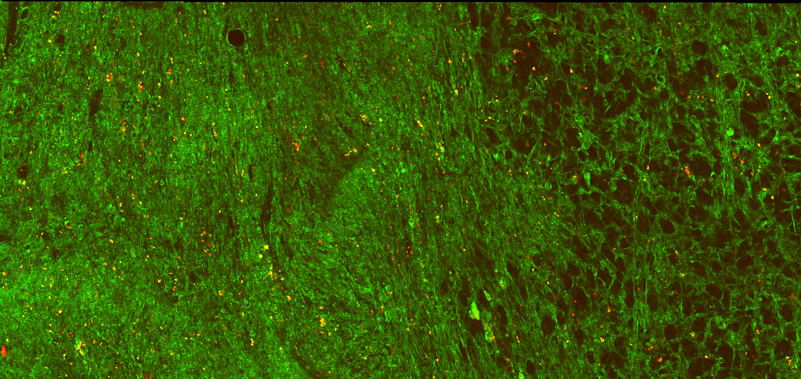 Combining nonlinear microscopy and deep learning classification for glioma diagnosis