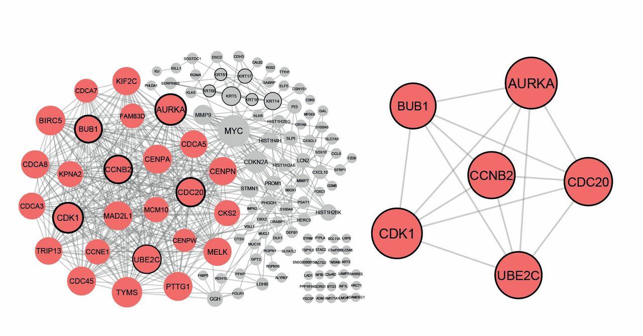 A novel age-related gene expression signature associates with proliferation and disease progression in breast cancer