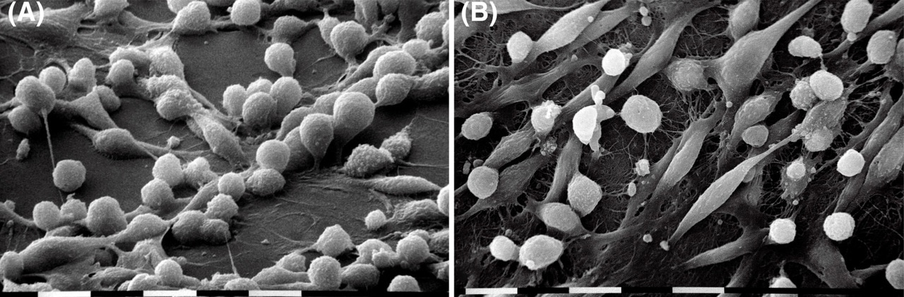 World Cancer Day at The FEBS Journal