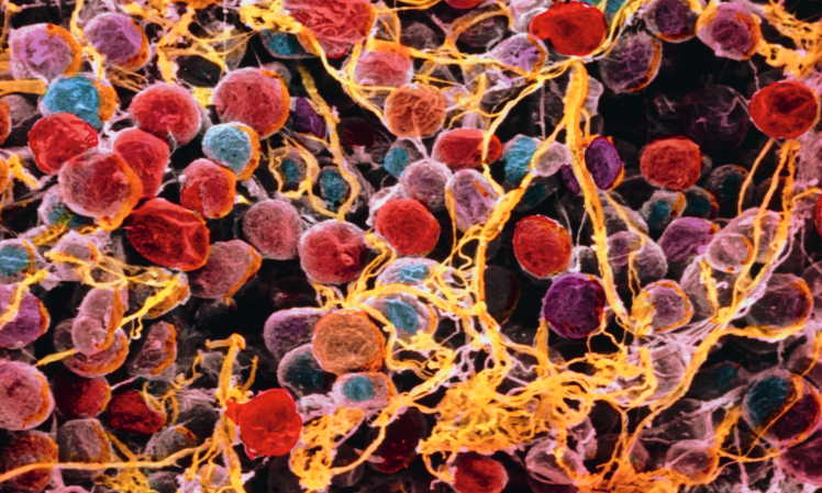 The FEBS Journal's Special Issue on Extracellular Matrix in Health and Disease
