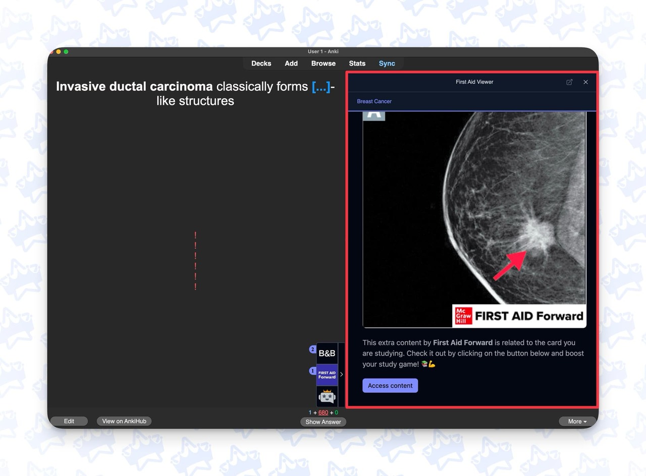 Anki, Boards & Beyond, and First Aid Forward Integration