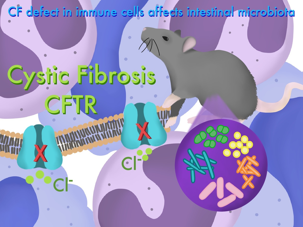 How the immune defect and epithelial defect contribute to CF