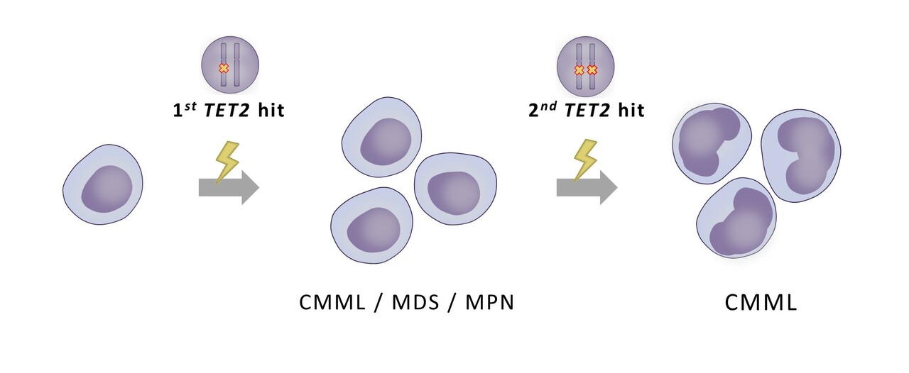 Multi-hit TET2 mutations as a new molecular signature in chronic myelomonocytic leukemia