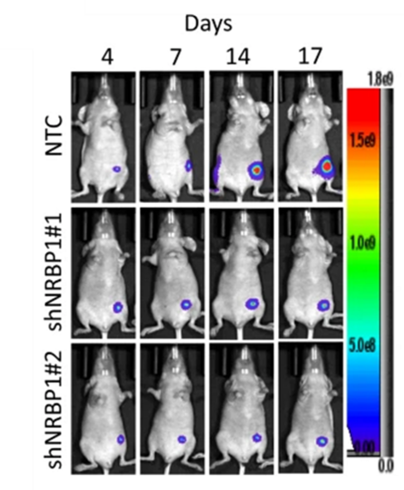 The pseudokinase NRBP1 activates Rac1/Cdc42 via P-Rex1 to drive oncogenic signalling in triple negative breast cancer