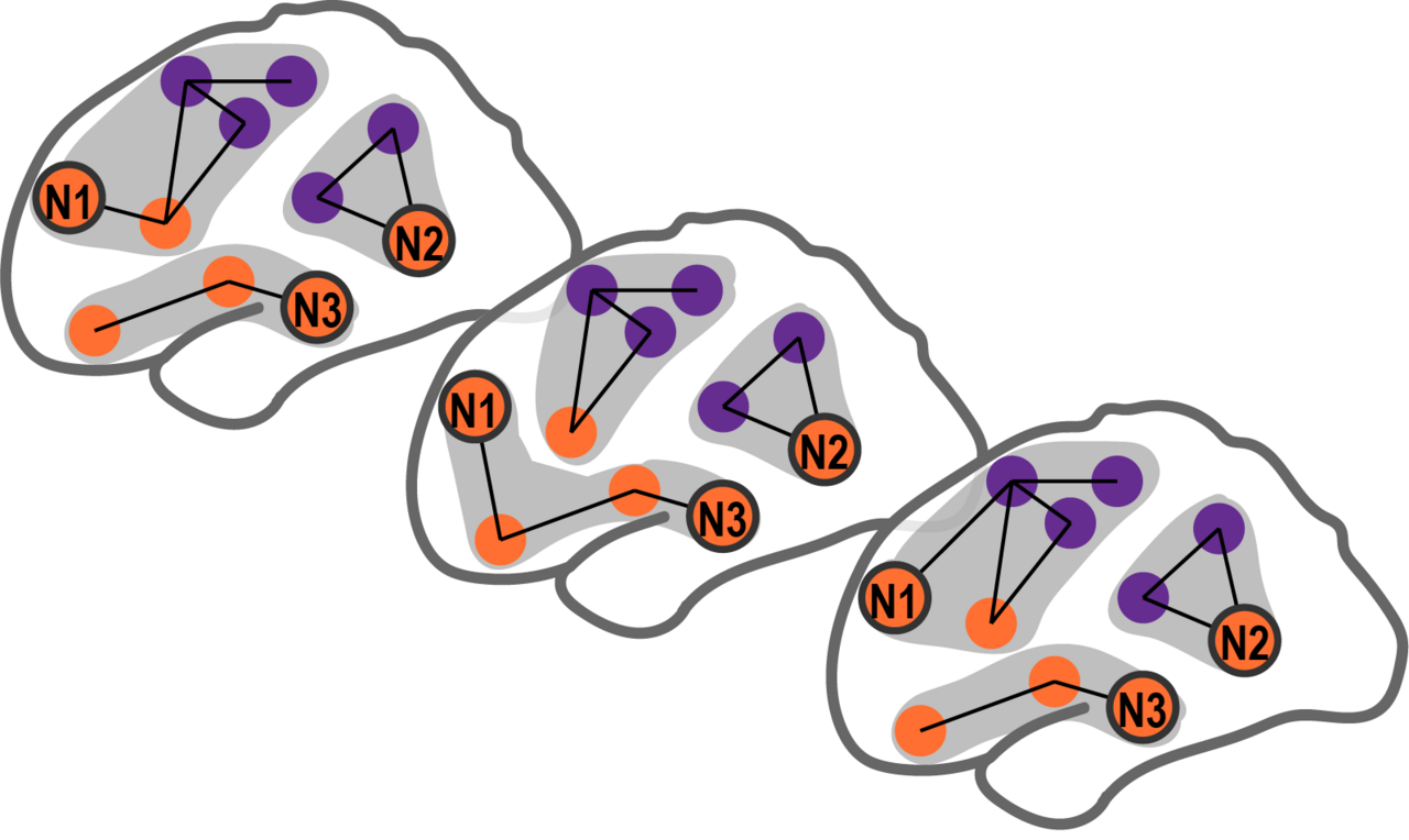 Regaining functionality - how do amputees’ brains incorporate sensory stimulation and combine somatosensory and visual inputs?
