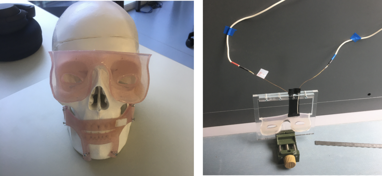 Design of an artificial muscle for facial paralysis