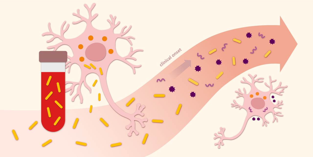 Plasma biomarkers of neurodegeneration in patients and high risk subjects with Lewy body disease