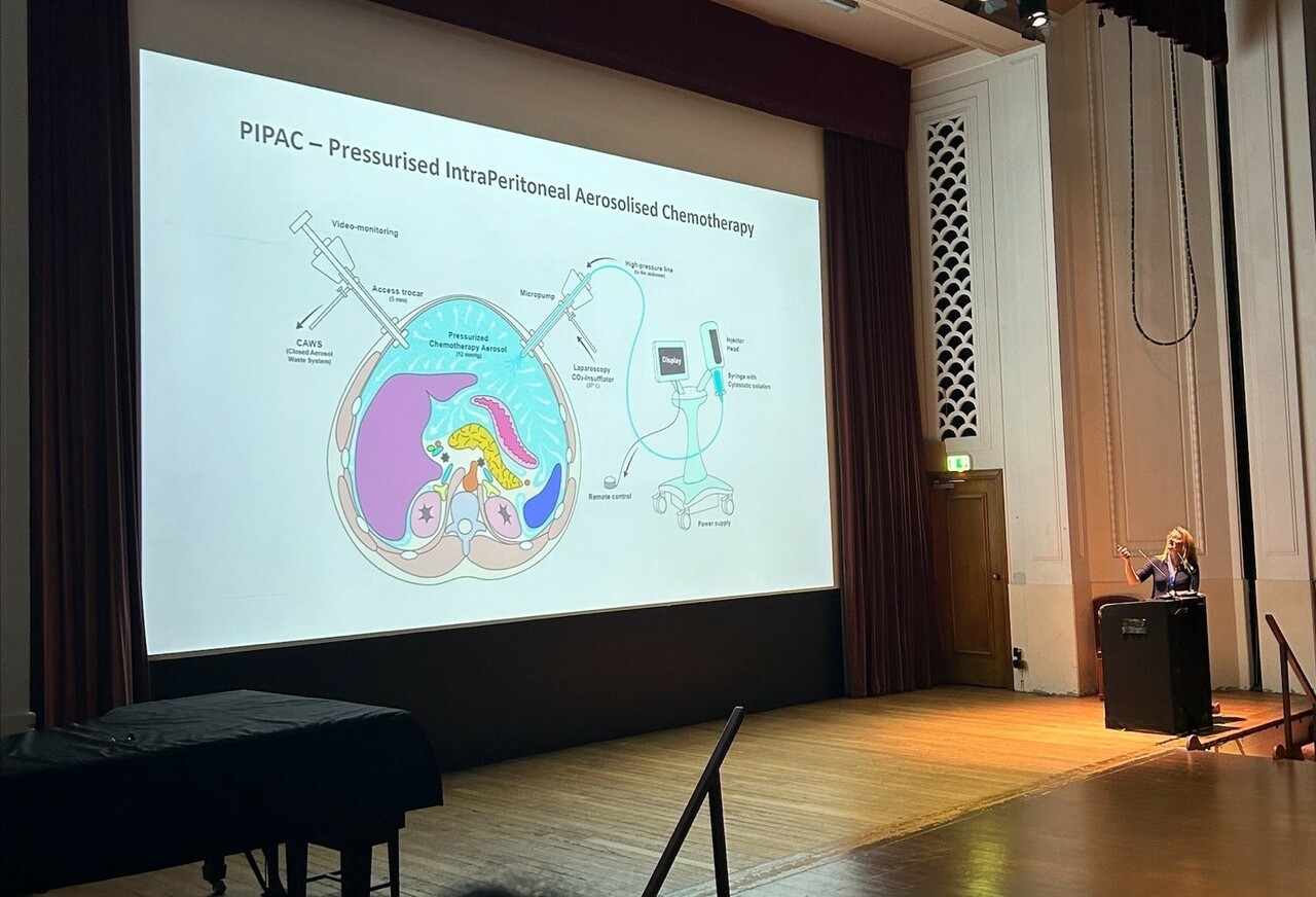 The PICCOS trial of experimental spray chemotherapy