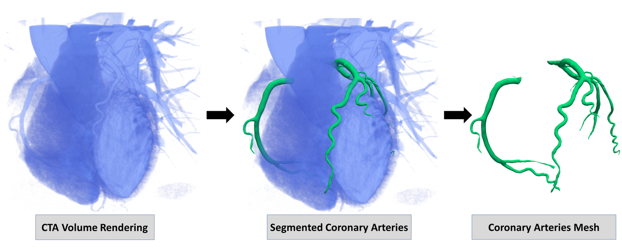 Unveiling the Potential of ASOCA Dataset: Advancing Cardiovascular Diagnostics and Treatment