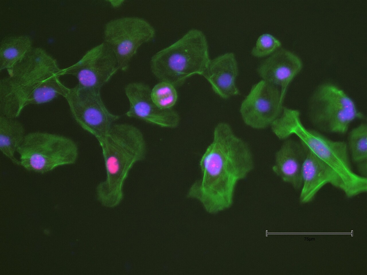 ACK1 Inhibition Epigenetically Reprograms Cell Cycle Genes and Overcomes Breast Cancer Resistance to CDK4/6 Inhibitor