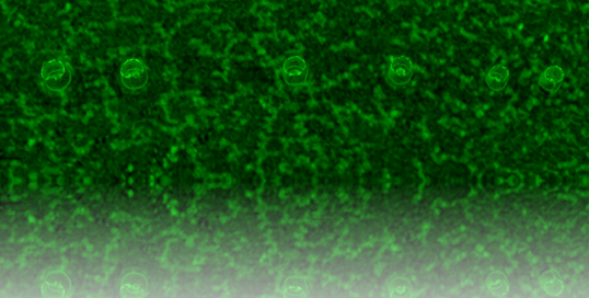 A micrometer-scale self-assembled platform around a human centriole: How does it form, and what to make of it after all?