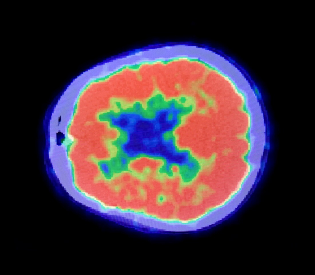 Top 100 of 2024 in Cancer| Scientific Reports